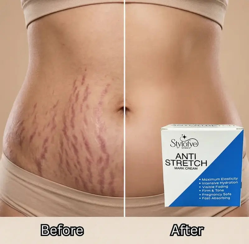 Stylofye Anti Stretch Mark Cream with Serum