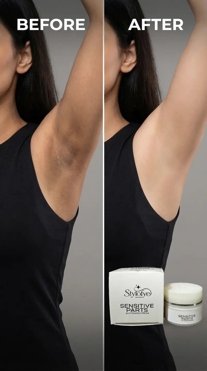 Stylofye Sensitive Parts Whitening Cream